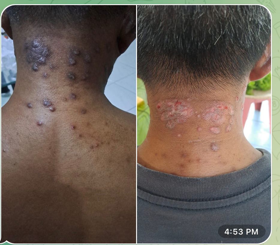 Hasil Penggunaan Bio Sea Pati Gamat Putih 1